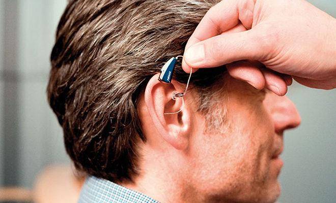 13 лучших слуховых аппаратов – Рейтинг 2020